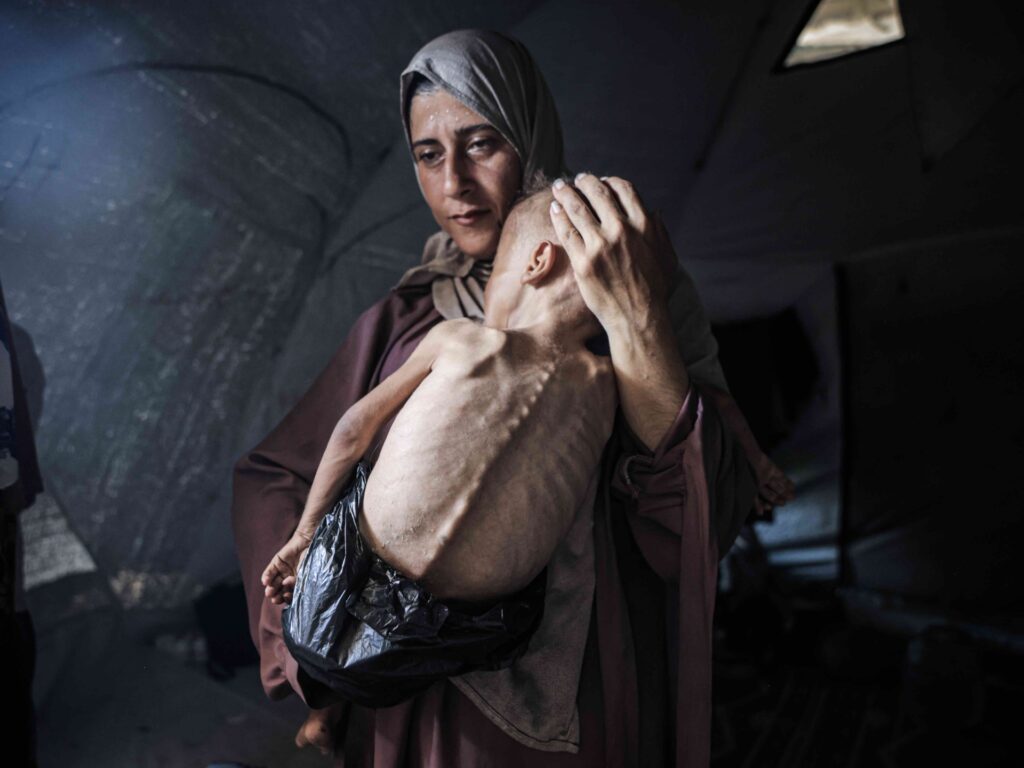 Gaza Child Had 'Pre-Existing Health Problems'